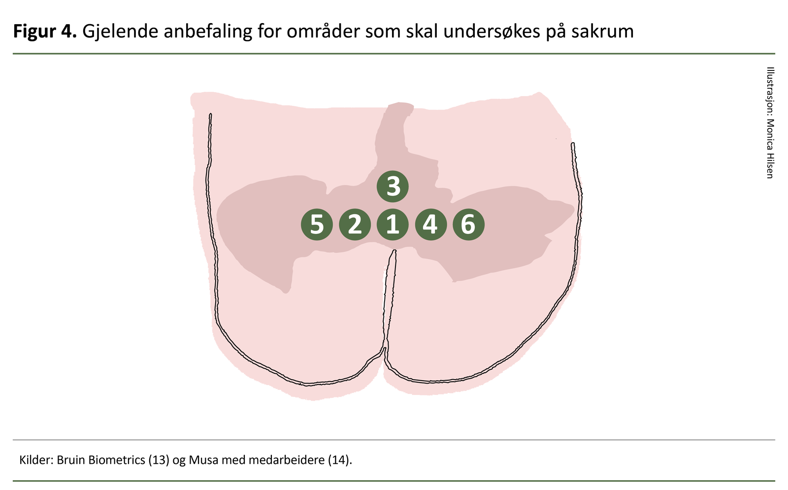 Gjelende anbefaling for områder som skal undersøkes på sakrum