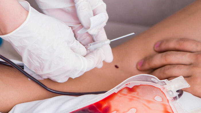 Blodoverføring Bildet viser en situasjon der det tappes blod.