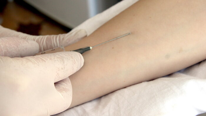 Bildet viser en hånd som legger inn nål i en arm.
