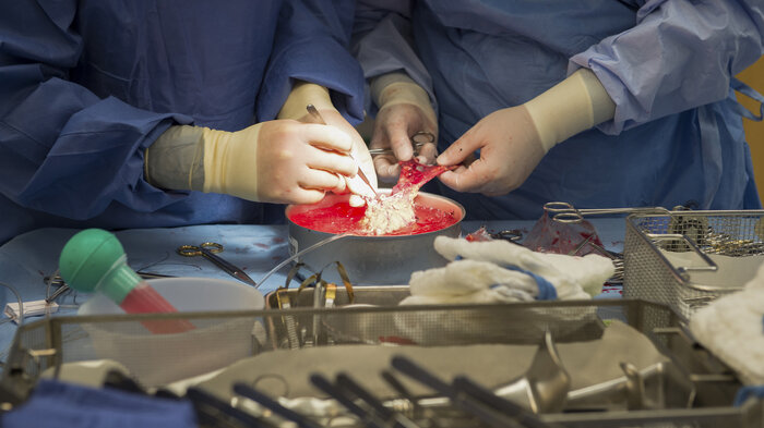 Bildet viser kirurger som jobber med en nyre.