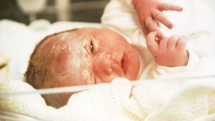 Bildet viser en nyfødt baby.