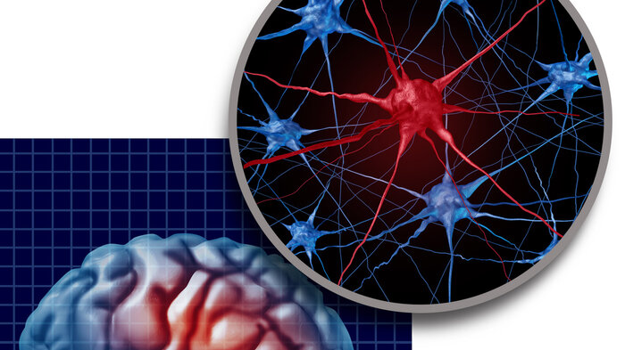 Bildet viser en animasjon av Parkinson