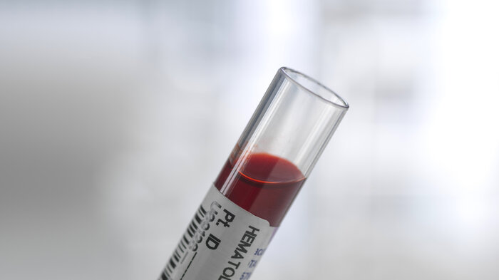 Bildet viser et blodprøveglass med blod i.