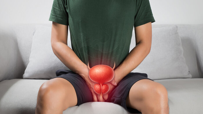 Bildet er et illustrasjonsbilde av en mann med prostatakreft