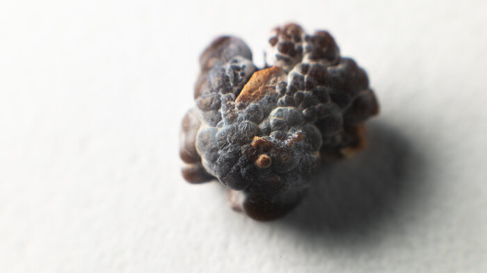 bilde av en nyrestein