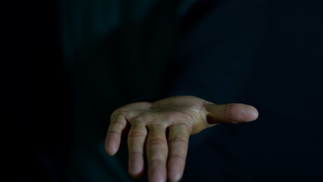 Bildet viser en håndflate som er strukket ut 