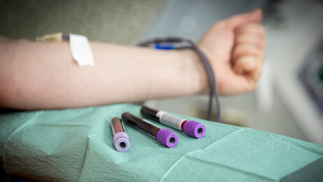 Bildet viser at det blir tatt blodprøver av et menneske. Ved siden av armen ligger tre prøveglass.