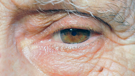 Illustrasjonsfoto: Mostphotos