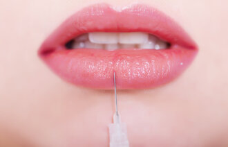 Bildet viser en sprøyte med botox som injiseres i kvinnelepper.