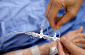 Bildet viser hender som ordner med et perifert venekateter.