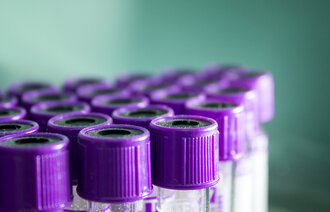 Bildet viser blodprøveglass.