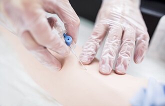 Bildet viser innleggelse av perifert venekateter.