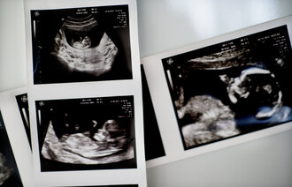 Tidlig ultralydbilder