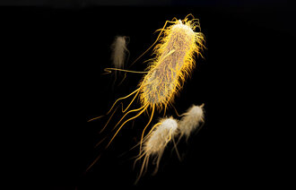 Bildet viser ESBL (extended-spectrum ­beta-lactamase).