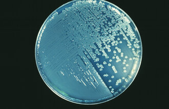 Bildet viser en petriskål med Pseudomonas aeruginosa.