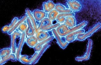 Bildet viser et mikrofotografi av et marburgvirus 