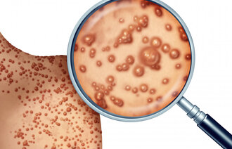 Bildet viser apekopper