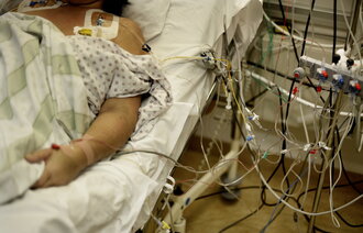 Bildet viser en intensivpasient som ligger i en sykehusseng påkoplet mye medisinsk utstyr