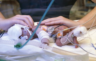 Bildet viser et ekstremt prematurt barn.