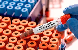 Bilde av mycoplasma pneumoniae-test