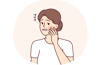 Illustrasjonen viser en kvinne med utslett på kinnet.