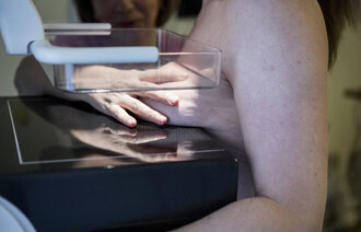 The photo shows mammography. A nurse's hand is placing a woman's breast between a glass plate and the cover beneath