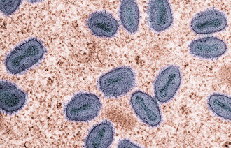 Bildet viser m-koppevirus i en celle.