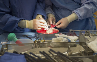 Bildet viser kirurger som jobber med en nyre.