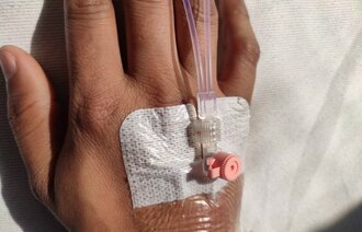 The photo shows a hand with a venous catheter in the vein