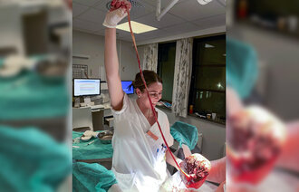 Bildet viser Anette Borgen Fjellhøy som holder opp navlesnor.