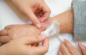 Bildet viser en eldre pasient som får sårbehandling