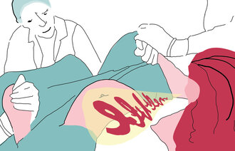 Illustrasjon av fødsel