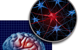 Bildet viser en animasjon av Parkinson