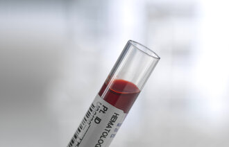 Bildet viser et blodprøveglass med blod i.