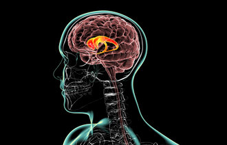 Bildet viser en illustrasjon som viser hvordan Huntington genet angriper hjernen