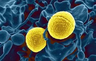 bilde av stafylokokker