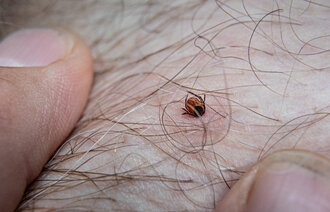 bilde av flåttbitt