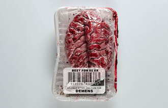 Bildet viser en vakuumpakket hjerne