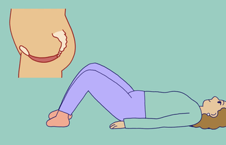 The illustration shows a woman’s pelvic floor, as well as a woman lying on the floor with her knees bent, ready for pelvic floor training.n viser en kvinnes bekkenbunn samt en dame som ligger på gulvet med bøyde knær, klar for bekkenbunnstrening