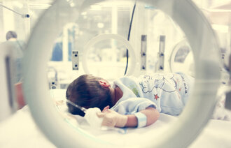 Bildet viser en nyfødt baby inne i en kuvøse.