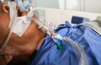 Bildet viser en respiratorpasient med en endotrakealtube via munn.