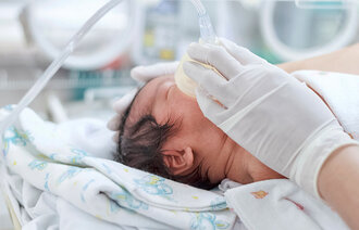 Liten baby som får oksygen tilført gjennom maske