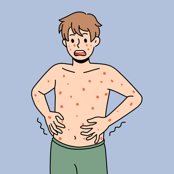 Illustrasjonen viser en gutt full av røde prikker.