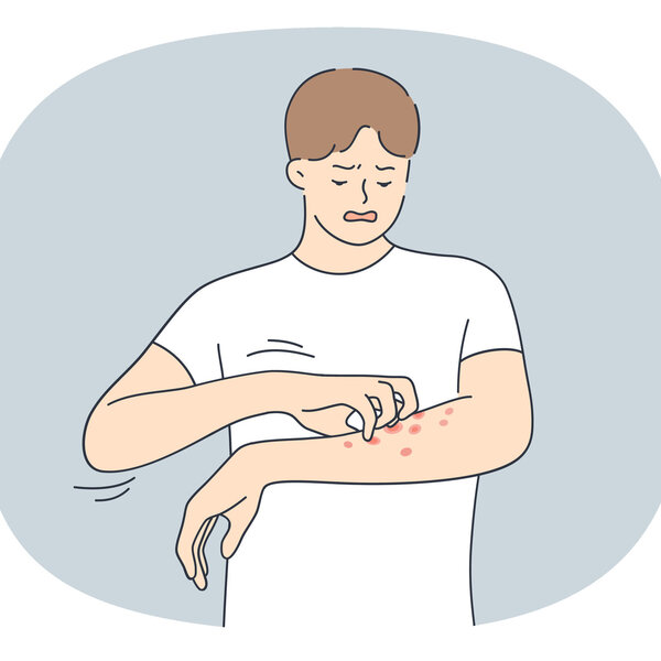Illustrasjonen viser en mann som klør på et utslett på armen.