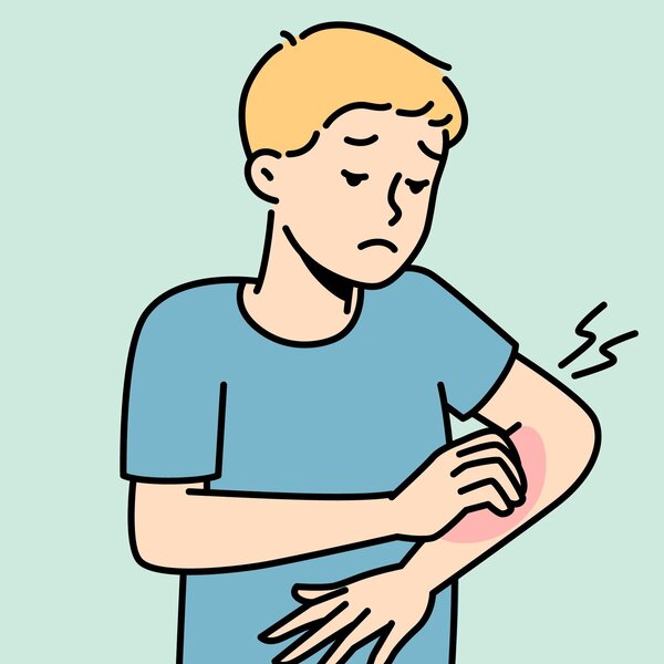 Illustrasjonen viser en gutt som klør seg på armen.