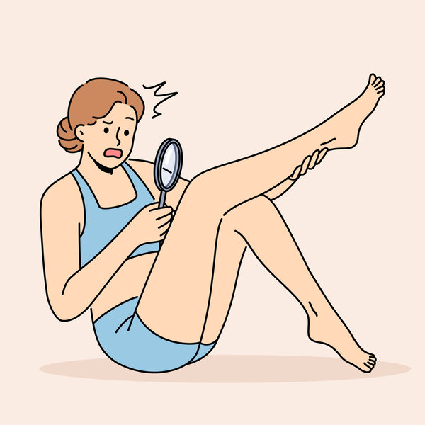 Illustrasjonen viser en kvinne som ser på benet sitt med forstørrelsesglass.