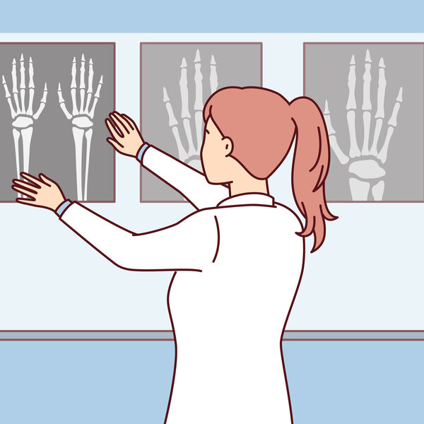 Illustrasjonen viser en helsearbeider som ser på røntgenbilder.