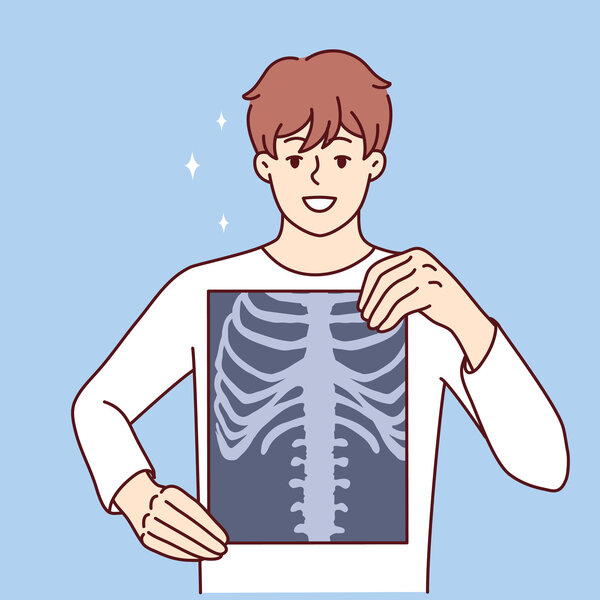 Illustrasjonen viser en gutt som holder opp et røntgenbilde av thorax.