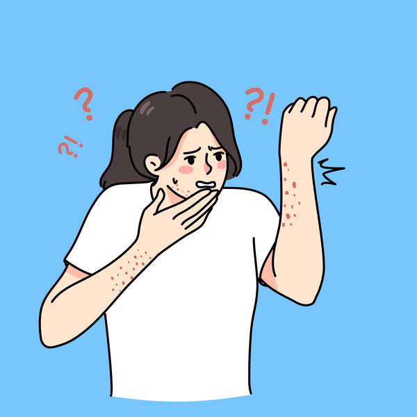 Illustrasjonen viser en kvinne med utslett på armene.