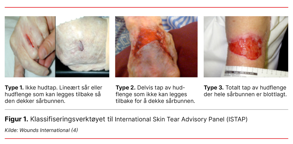 Figur 1. ISTAPs klassifiseringsverktøy